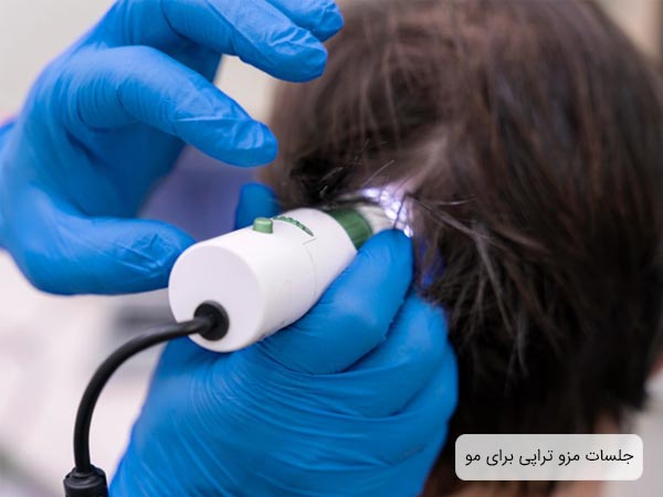 مزو تراپی موی سر توسط پزشک متخصص.