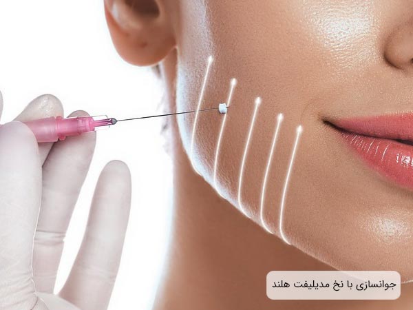 ليفت صورت يک خانم بوسيله نخ ليفت صورت مدی ليفت.