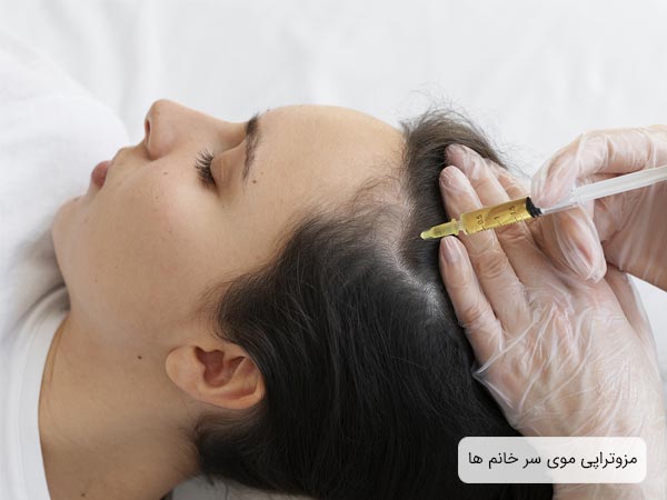 مزوتراپی موی سر يک خانم جوان.
