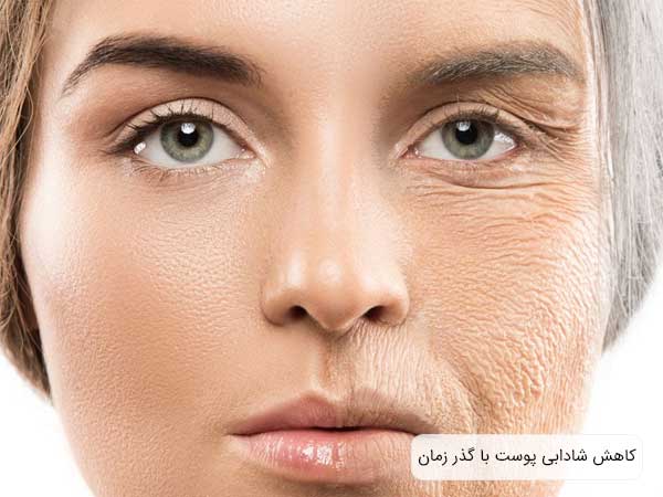 تاثيرات گذر زمان بر روی پوست صورت يک خانم.