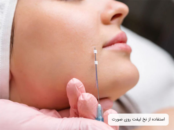 استفاده از نخ ليفت براي ليفت صورت يک خانم توسط متخصص.