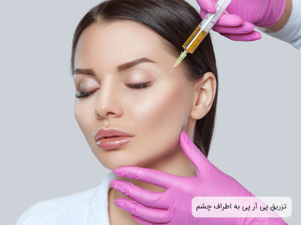 تزريق پی آر پی زير چشم به يک خانم توسط متخصص.