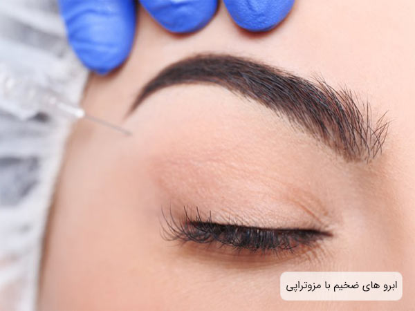 ابرو های ضخيم و پرپشت يک خانم در کنار سرنگ مزوتراپی.