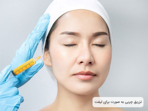 پزشک در حال تزريق سرنگ حاوی چربی به صورت يک خانم است.