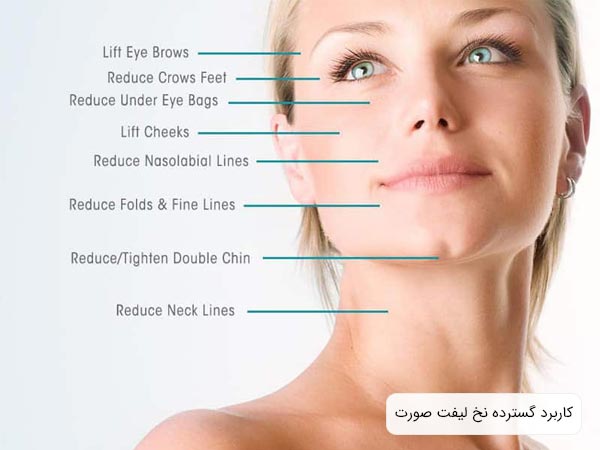 استفاده از نخ ليفت در قسمت هاي مختلف صورت.