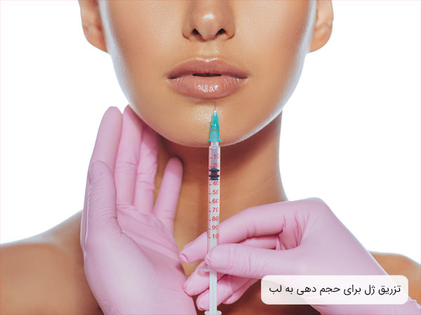 تزريق ژل به لب يک خانم با پس زمينه سفيد.