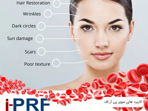 صورت يک خانم و کاربرد های سوپر پی آر اف که در پس زمينه تصوير نوشته شده است.