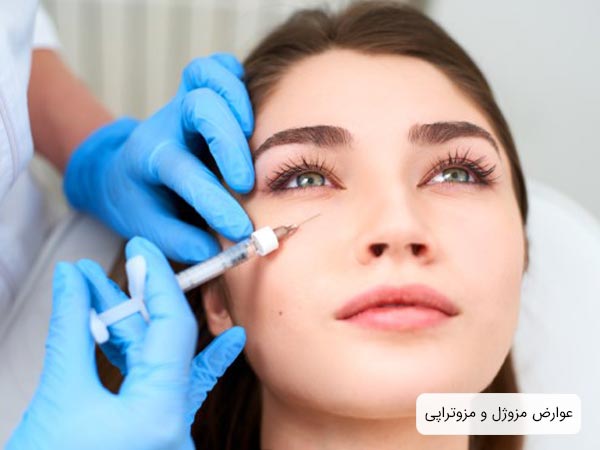 تزريق مزو ژل به صورت يک خانم
