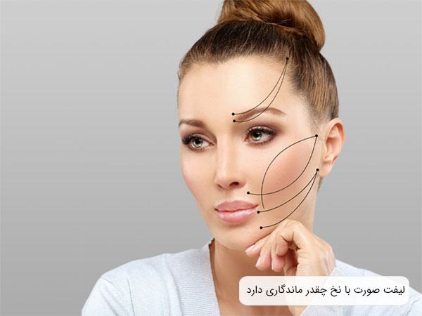 نقاط استفاده از نخ ليفت که بر روی صورت يک خانم نمايش داده شده است.