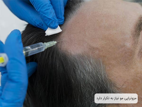 مزوتراپی موی سر يک آقا توسط پزشک.
