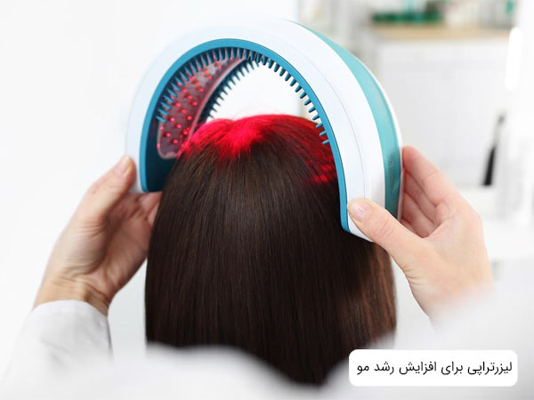 ليزرتراپی موی سر يک خانم.