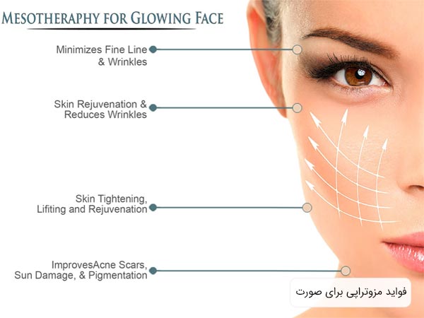 اهميت و تاثيرات مزوتراپی براي صورت در کنار صورت يک خانم جوان نوشته شده است با پس زمينه سفيد.
