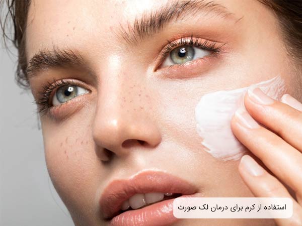 يک خانم جوان که از کرم بر روی لک های قهوه ای پوست صورت خود استفاده مينمايد.