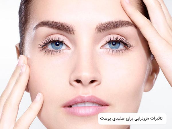 پوست صورت يک خانم که با مزوتراپی زيبا و شاداب گشته است با پس زمينه سفيد.