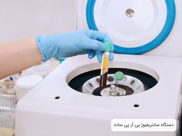 يک عدد دستگاه پی آر پی مدرن و ساده.