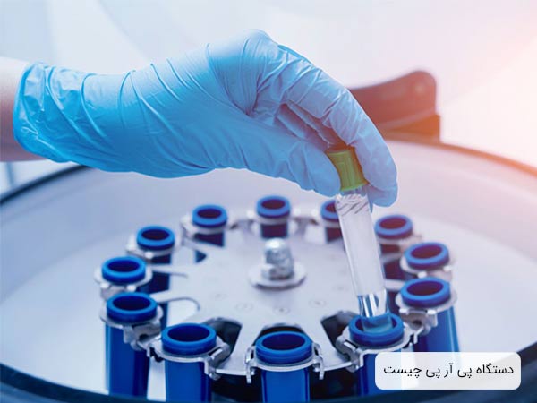 تعدادی ظرف آزمايشگاهی در يک دستگاه سانتريفيوژ قرار گرفته اند.