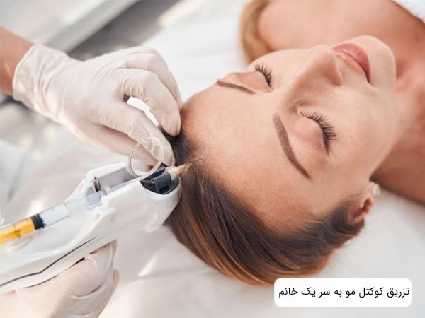 انجام مزوتراپي مو توسط متخصص روي سر يک خانم.