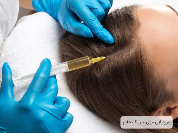 تزريق کوکتل مزوتراپی به سر يک خانم توسط پزشک.