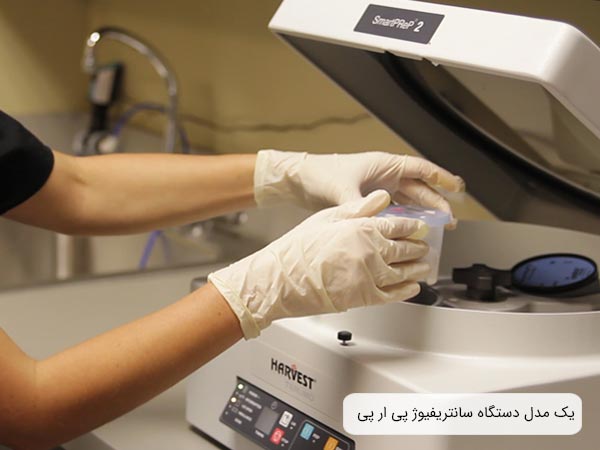 يک خانم در حال کار کردن با دستگاه سانتريفيوژ prp .