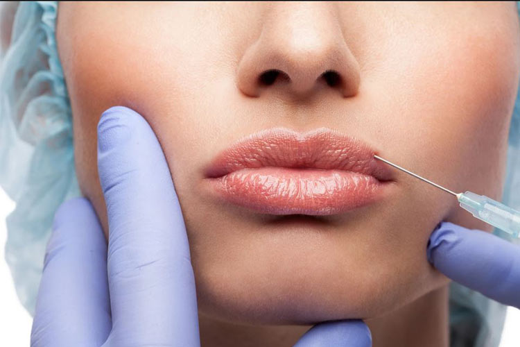 تزريق ژل لب به لب های يک خانم توسط پزشک.