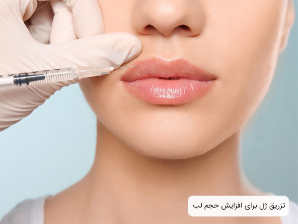 تزريق ژل يا فيلر به لب يک خانم توسط دکتر.