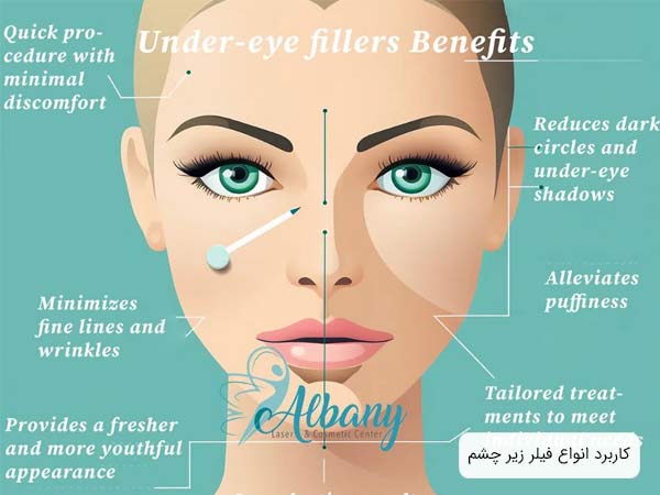 توضيحاتی در مورد کاربرد و تاثيرات فيلر در قسمت زير چشم.