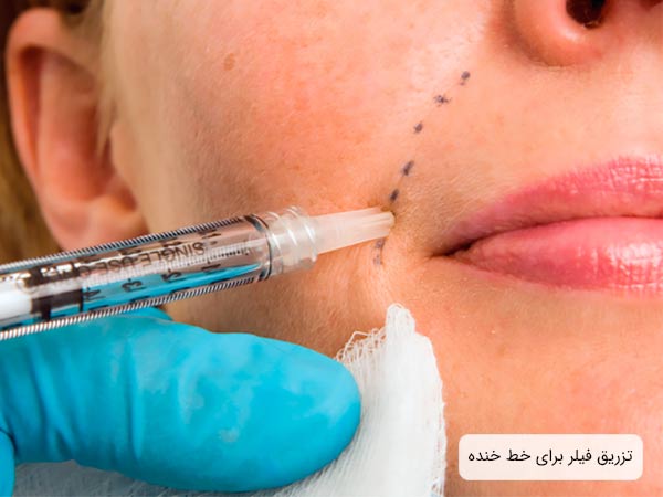 تزريق فيلر به صورت يک خانم توسط پزشک.