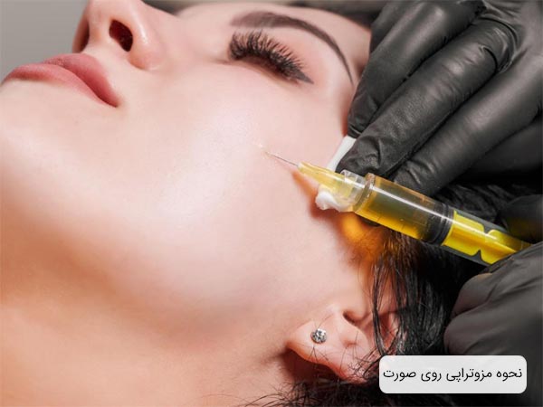 تزريق مزوتراپي روي صورت يک خانم توسط پزشک.