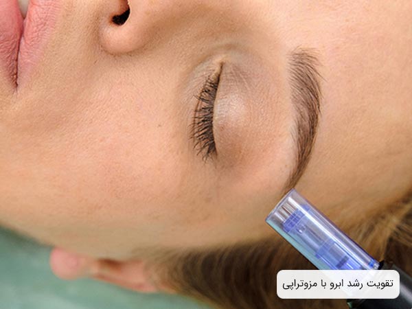 تجهيزات مزوتراپی که در کنار ابروی يک خانم قرار داده شده است.