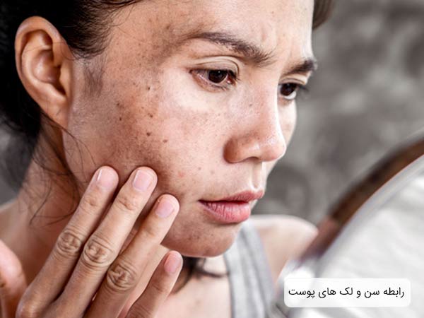 يک خانم مسن که در حال نگاه کردن به لک های پوستی خود است.