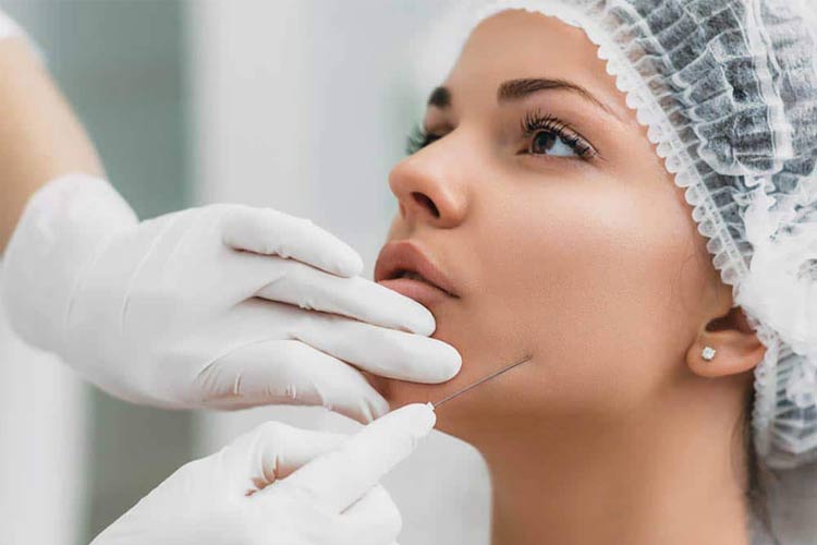 انجام ليفت با نخ توسط پزشک روی صورت يک خانم.