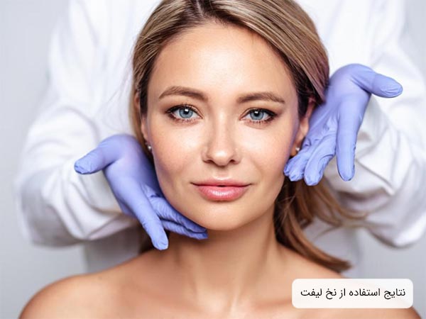 صورت يک خانم بعد از انجام عمل ليفت با نخ.