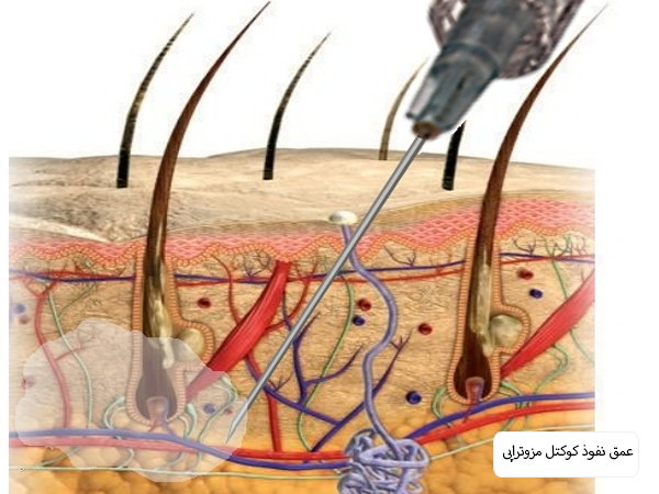 صورت يک خانم قبل و بعد از درمان لک های قهوه ای پوست.