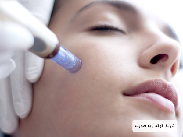 انجام مزوتراپی توسط متخصص روی صورت يک خانم جوان