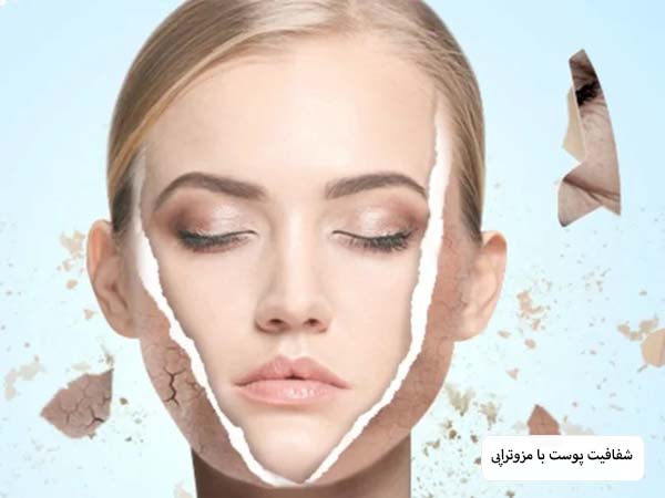 صورت شفاف و براق یک خانم بعد از مزوتراپی
