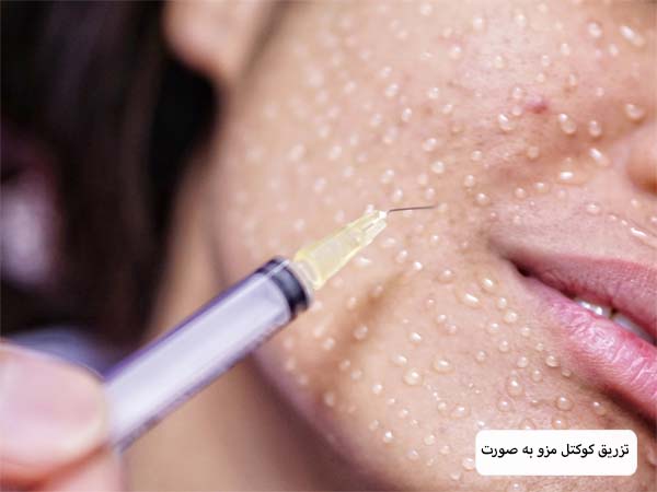 صورت يک خانم قبل و بعد از درمان لک های قهوه ای پوست.
