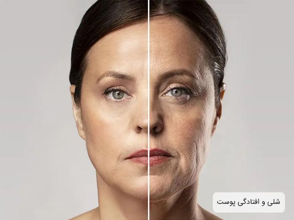 صورت يک خانم قبل و بعد از انجام ليفت صورت در پس زمينه طوسی رنگ.