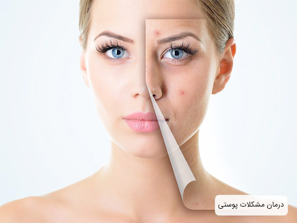 پوست صورت صاف و شفاف يک خانم بعد از درمان آن در پس زمينه سفيد.