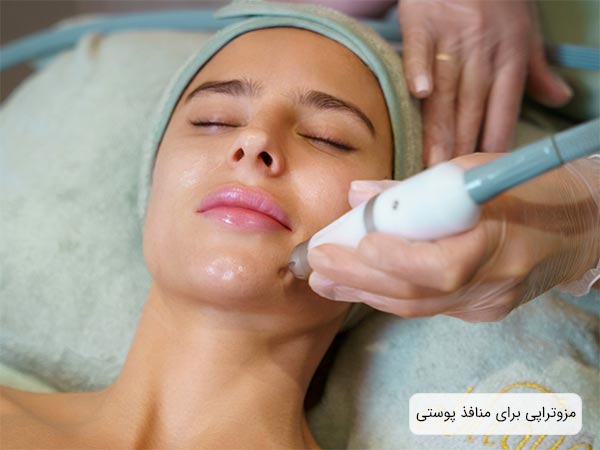انجام مزوتراپی روي صورت يک خانم جوان توسط متخصص.