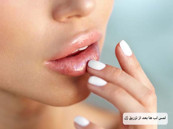 یک خانم در حال لمس های خود بعد از تزریق فیلر است.