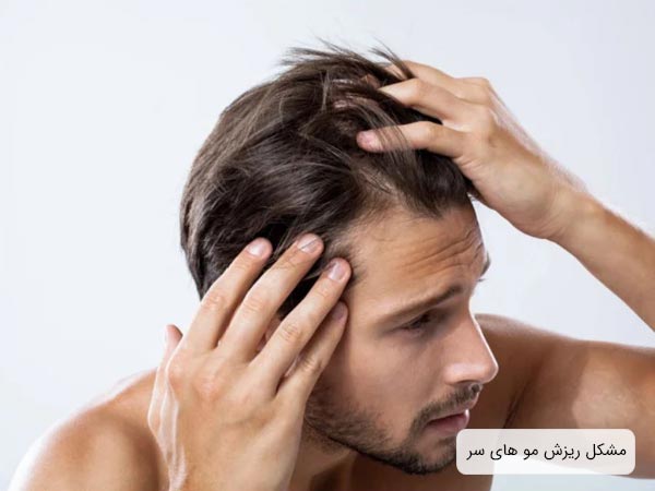 يک آقا که با نگرانی درحال بررسی مو های خود است در پس زمينه سفيد.