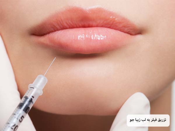 تزریق فیلر به لب یک زیبا جو توسط پزشک.