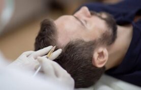 انجام مزوتراپی مو روی سر يک آقا توسط پزشک.