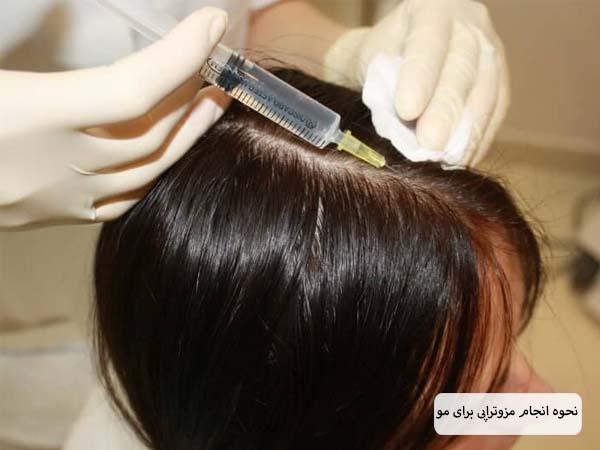 تزریق کوکتل مزوتراپی به سر یک خانم توسط پزشک.