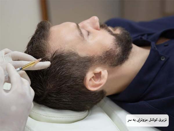انجام مزوتراپی روی مو های سر یک آقا توسط پزشک.