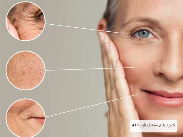 کاربرد های متنوع فیلر ای تی پی روی صورت یک خانم میانسال نمایش داده شده است.
