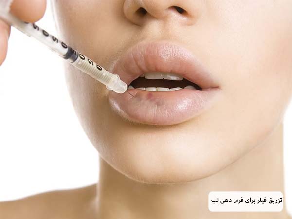 سرنگ مخصوص تزریق فیلر که روی لب های یک خانم جوان قرار گرفته است با پس زمینه سفید.