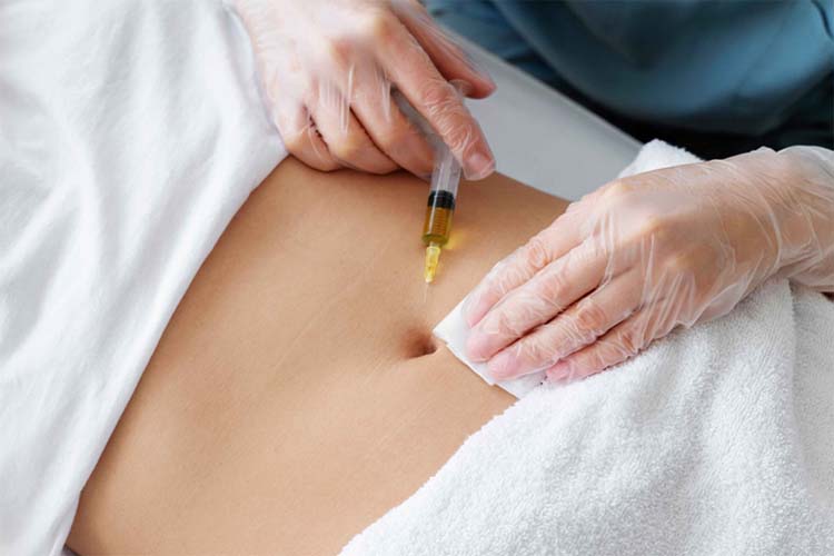 تزریق کوکتل مزوتراپی لاغری به شکم یک خانم توسط متخصص