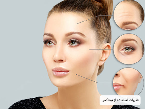 صورت يک خانم جوان که عد از تزريق بوتاکس بسيار صاف و شفاف بدون چين و چروک گرديده است.