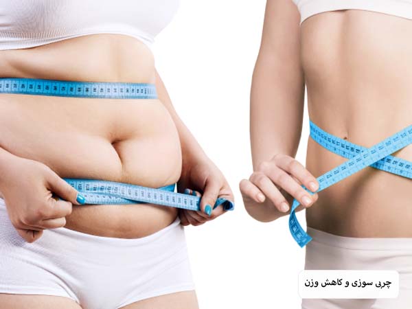 کاهش سایز شکم و وزن یک خانم بعد از تزریق کوکتل مزوتراپی در پس زمینه سفید.